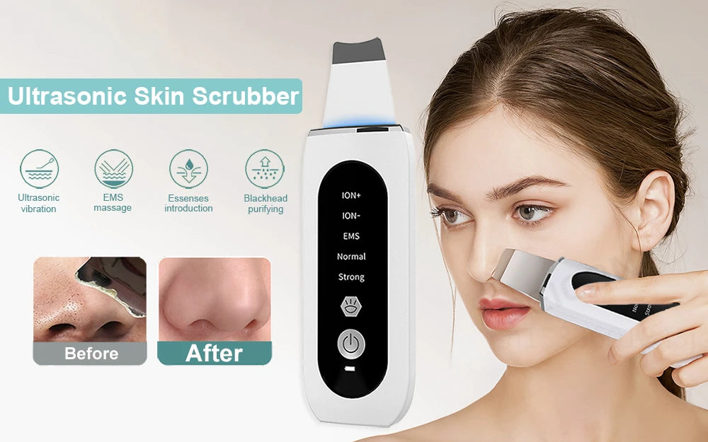 Ultrasonic Skin Scrubber Ultrasonic Deep Face Cleaning Peeling Blackhead Remover Facial Shovel Cleanser Lifting Skin Care