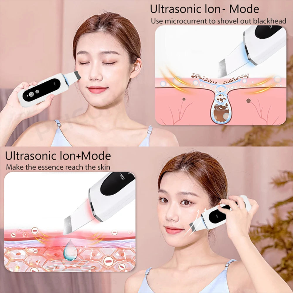 Ultrasonic Skin Scrubber Ultrasonic Deep Face Cleaning Peeling Blackhead Remover Facial Shovel Cleanser Lifting Skin Care